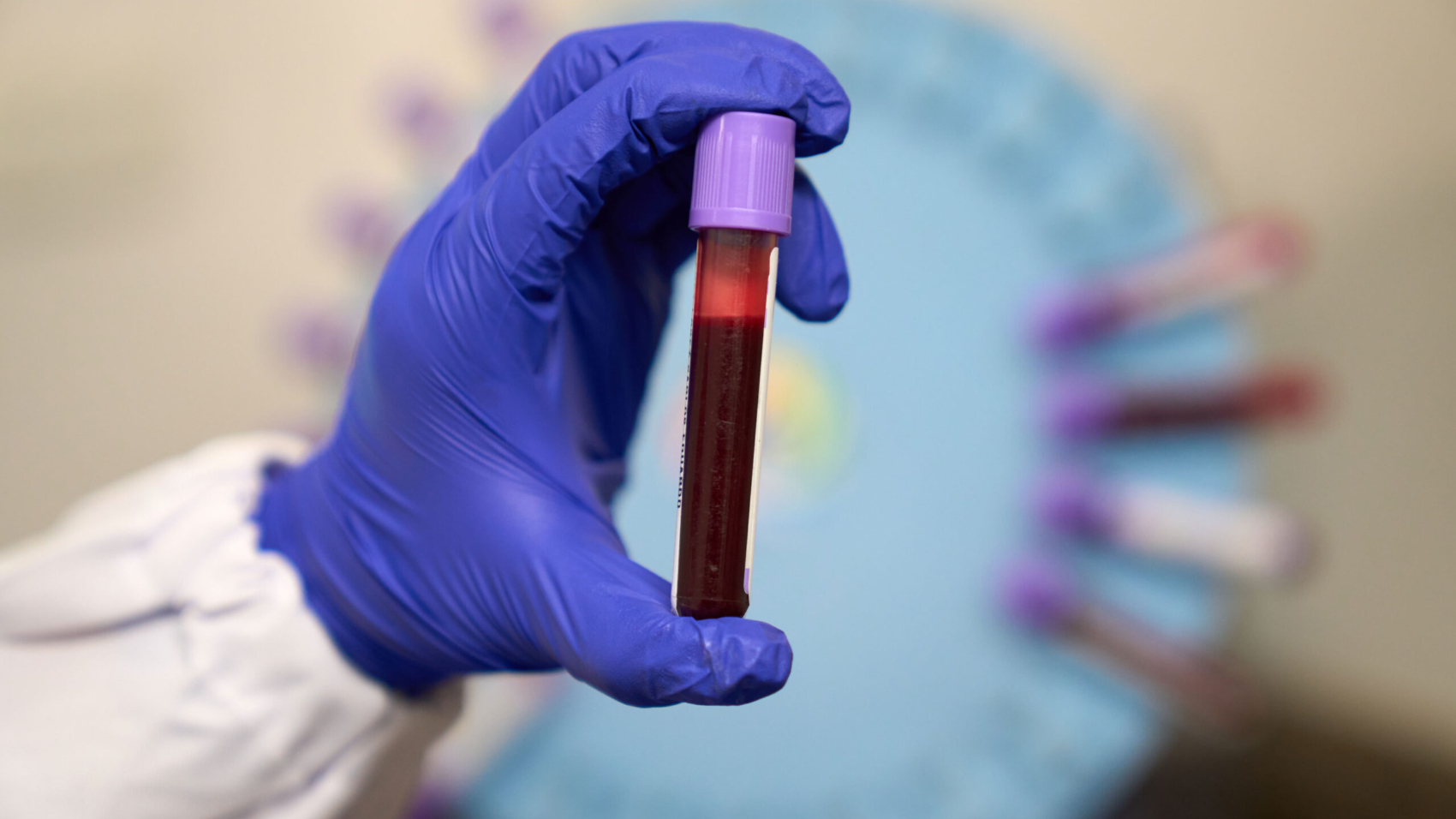 laboratio-examenes-de-sangre-en-Quito