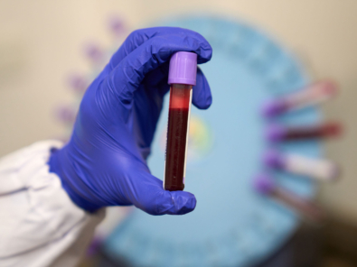 laboratio-examenes-de-sangre-en-Quito