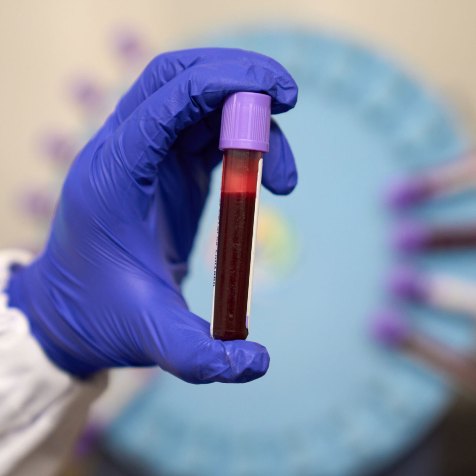 laboratio-examenes-de-sangre-en-Quito