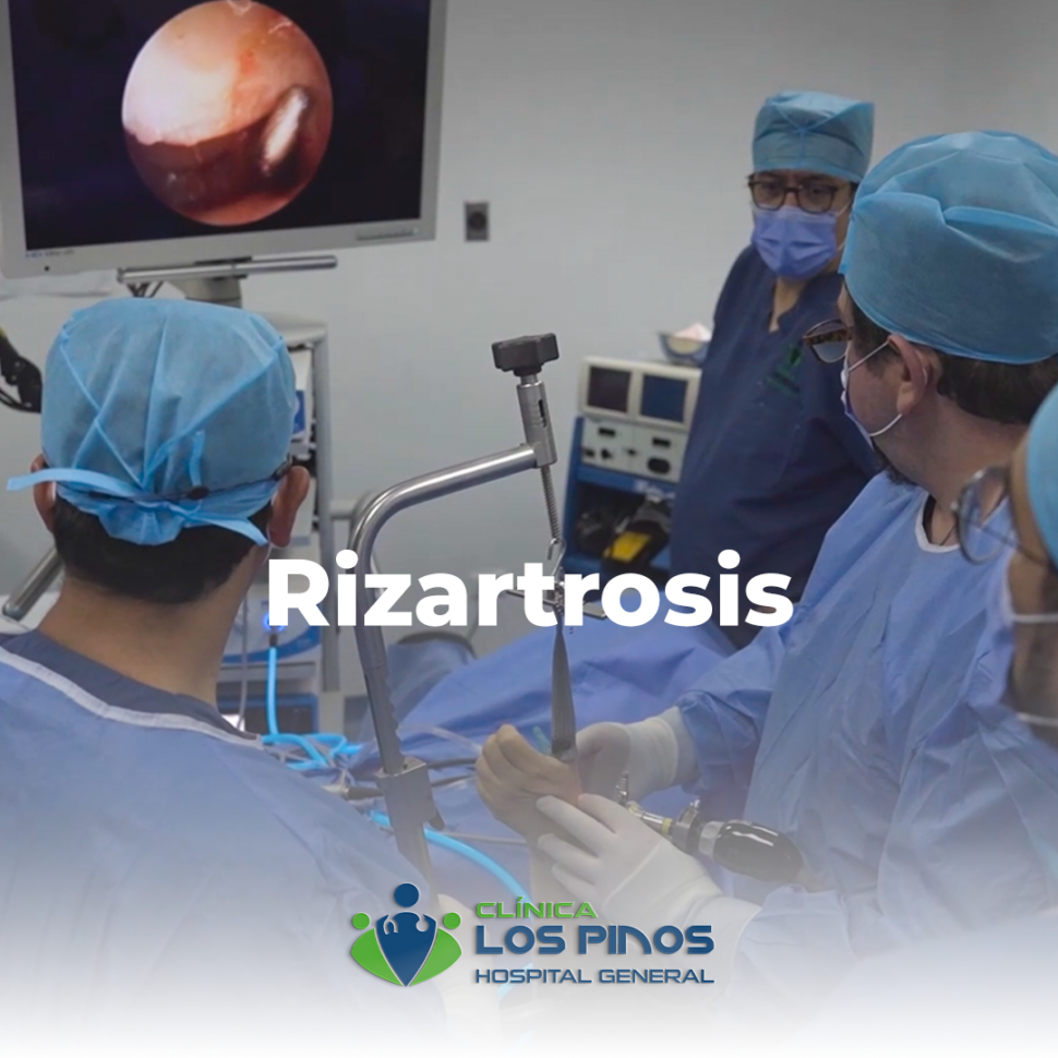 rizartrosis-artrosis-de-manos-clinica-los-pinos