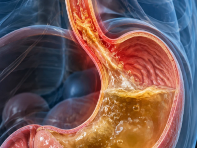 gastro-reflujo-visualizacion
